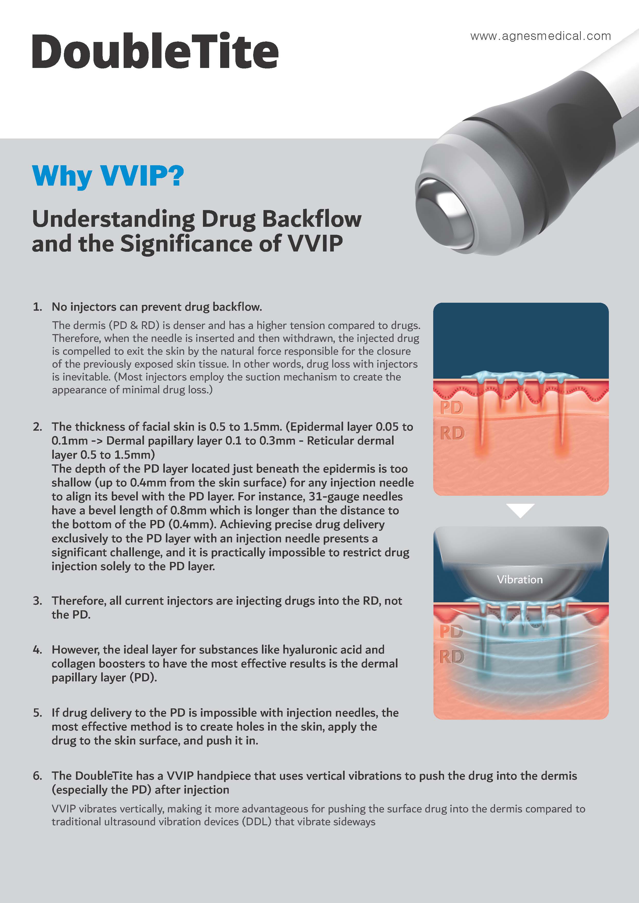 Double Tite - Cossur